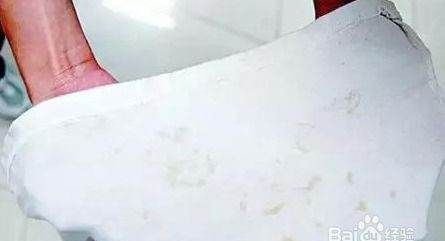 怎么洗荔枝汁,荔枝汁能洗掉吗图5