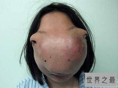 ​人类史上最怪异的十大畸形人，吓不死你算我输
