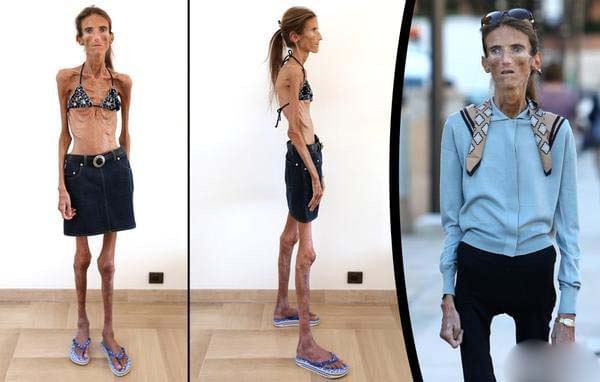 Valeria Levitin，体重27公斤