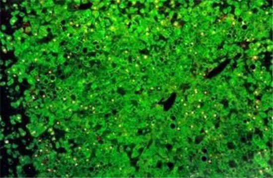 揭秘全球八例人兽杂交产物 科学的禁区