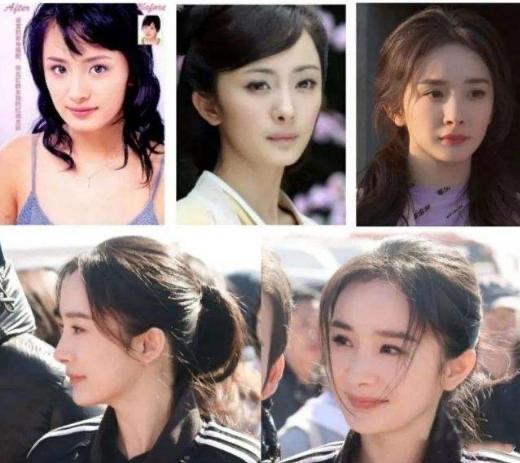 娱乐有种倔强叫“我没整容”，从方脸变成瓜子脸，真当网友看不见吗？  6