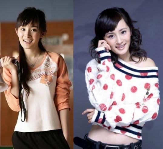 娱乐有种倔强叫“我没整容”，从方脸变成瓜子脸，真当网友看不见吗？  3