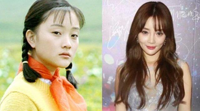 娱乐有种倔强叫“我没整容”，从方脸变成瓜子脸，真当网友看不见吗？  11