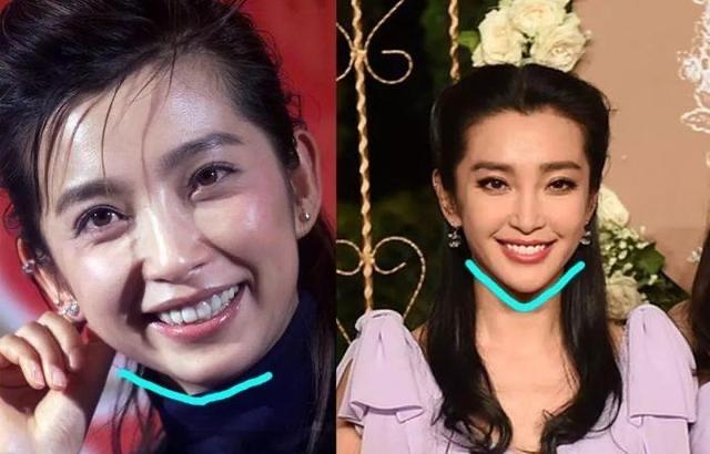 娱乐有种倔强叫“我没整容”，从方脸变成瓜子脸，真当网友看不见吗？  9