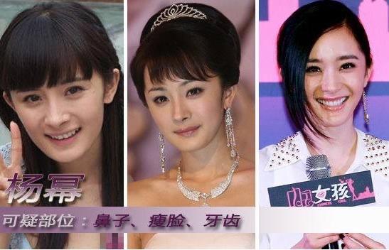 娱乐有种倔强叫“我没整容”，从方脸变成瓜子脸，真当网友看不见吗？  5