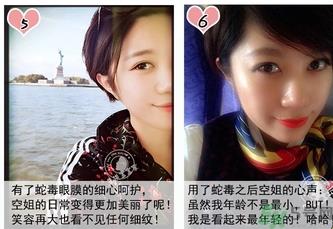 蛇毒眼膜孕妇可以用吗？ 日本spa蛇毒眼膜孕妇能用吗？