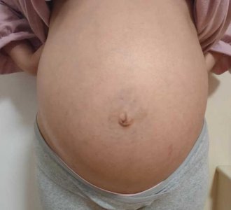 ​准妈妈晒出“腹部照”，这是入盆的肚子？这话坑了多少孕妇？