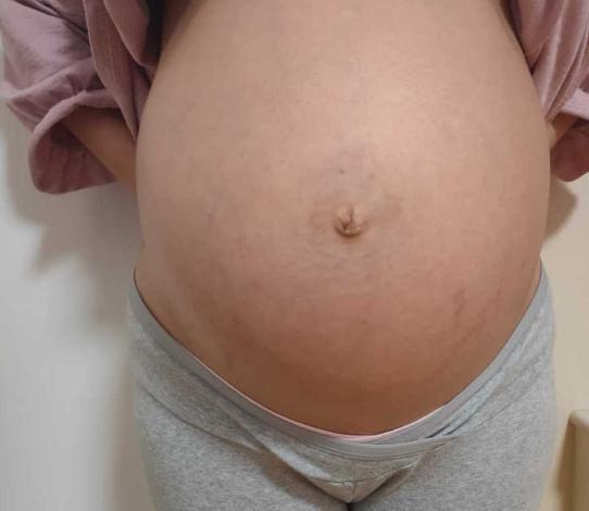 准妈妈晒出“腹部照”，这是入盆的肚子？这话坑了多少孕妇？