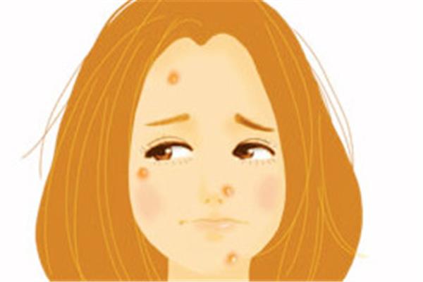 闭口和粉刺的区别 闭口和粉刺是一样的吗