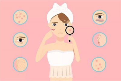 ​闭口和粉刺的区别 闭口和粉刺是一样的吗