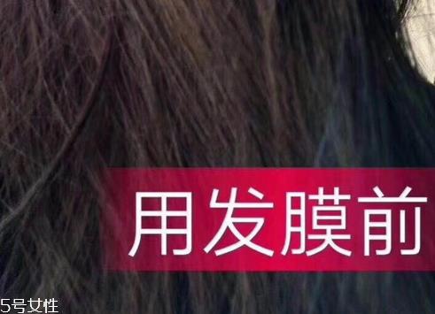 医采发膜怎么样 医采发膜使用前后对比图