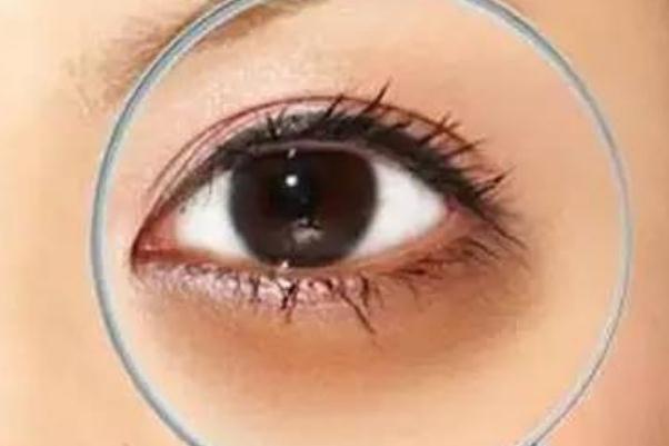 黑眼圈很重怎么去除 黑眼圈为什么很重