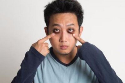 ​黑眼圈很重怎么去除 黑眼圈为什么很重