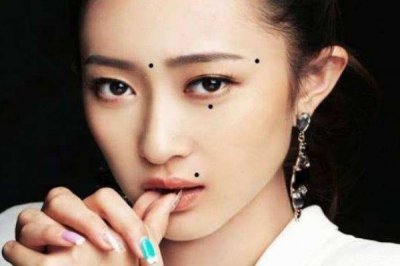 ​脸部的痣可以怎么去除呢 去除脸部痣的方法有什么呢