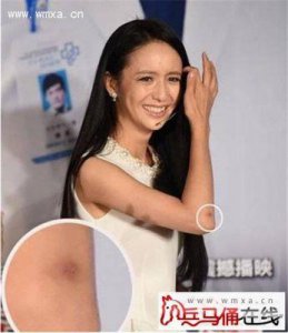​陈思成出轨丑闻再现，佟丽娅为何始终不离婚？