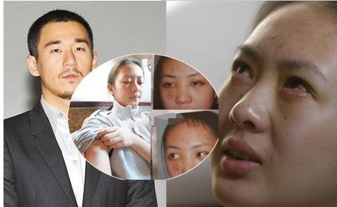 童瑶为什么会被张默打(童瑶跟张默什么关系) 童瑶 张默 第4张