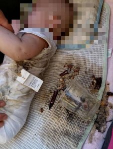 ​刚满100天女婴被天降烟灰杯砸中，物业排查200多户未找到抛物者