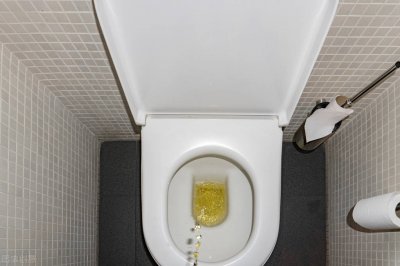 ​尿完记得看一眼！不同颜色的尿液藏着健康大秘密