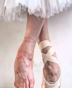 ​芭蕾女神血脚曝光！10年磨一脚，背后真相惊呆网友