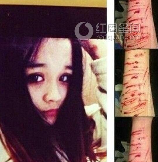 李耐阅王骁接吻照片 李耐阅自残照