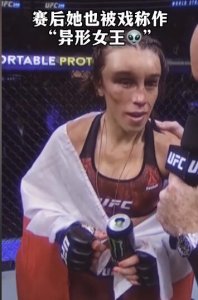 ​ufc乔安娜生活照 曾被张伟丽打到整容