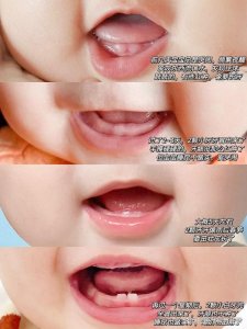 ​干货！宝宝出牙时间顺序详解图，附症状︎护理
