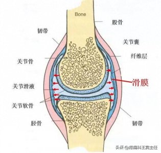 ​一分钟带你了解滑膜炎！